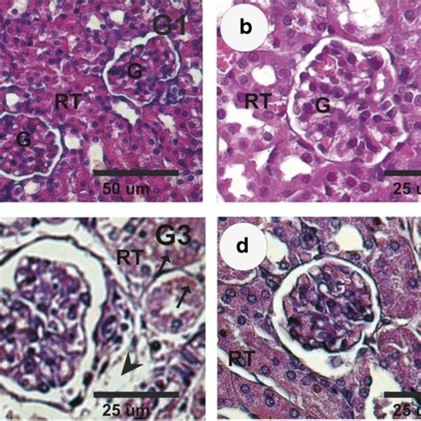 Photomicrographs Of Mice Renal Tissues Sections Of Different Groups