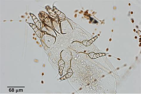 5 Diagnosis Of Arthropod Parasites Veterian Key