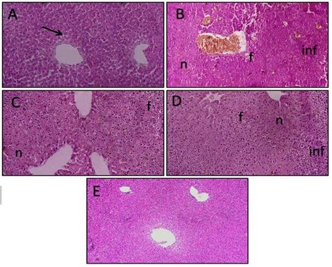 Photomicrograph Of Different Liver Sections Stained With Hande A Liver