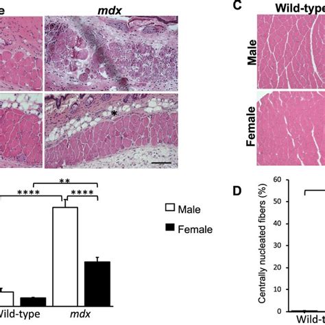 Pc Muscle Degenerationregeneration Is Sex Related A Histological