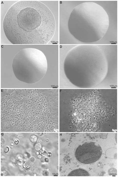 Comparison of L-form E. coli and classical E. coli morphologies. A E.... | Download Scientific ...