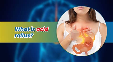 What Is Acid Reflux Disease Causes Of Acid Reflux