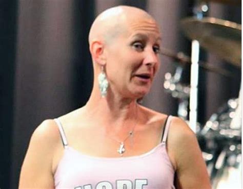 Woman Accused Of Faking Cancer To Get Thousands In Donations