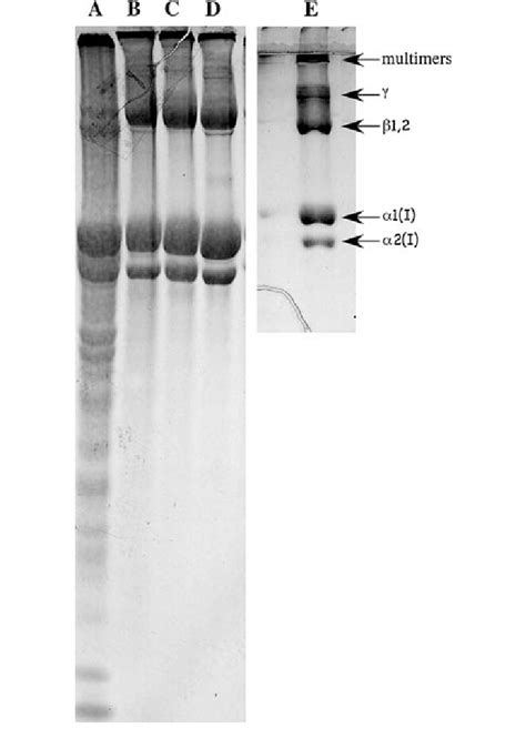 Sds Page Of Collagen Extractions Using Stacker Resolver And