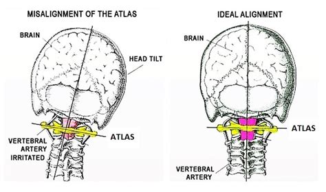 Welcome To Atlas Orthogonal Health Home