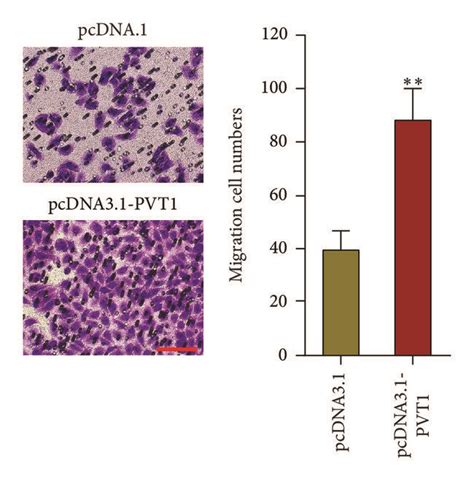 Overexpression Of Pvt1 Enhances Melanoma Cells Proliferation Cell