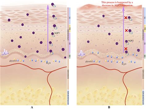 Jle European Journal Of Dermatology The Relationship Between