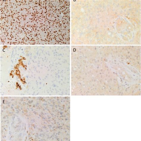 Representative 3 3 Diaminobenzidine Immunohistochemical Stained Images