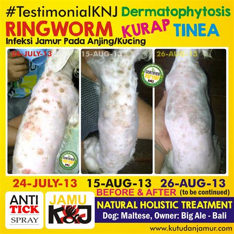 Ringworm Dermatophytosis Kurap Infeksi Jamur