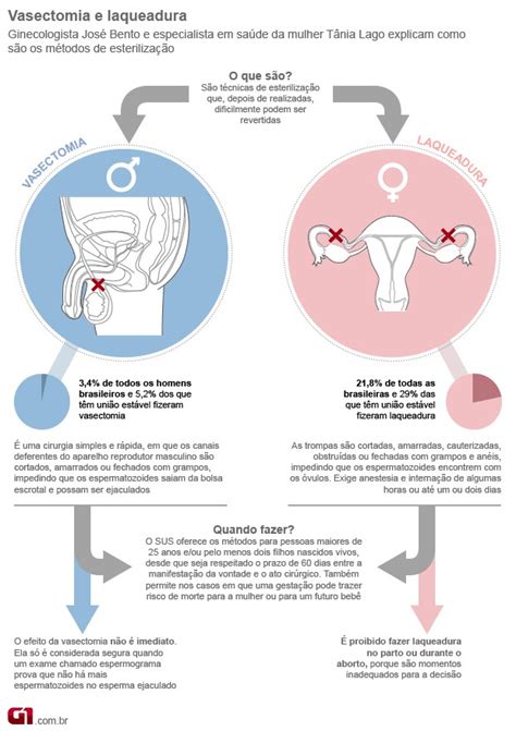 Vasectomia E Laqueadura - Bem Estar - Falha em laqueadura e vasectomia depende da técnica, dizem ...