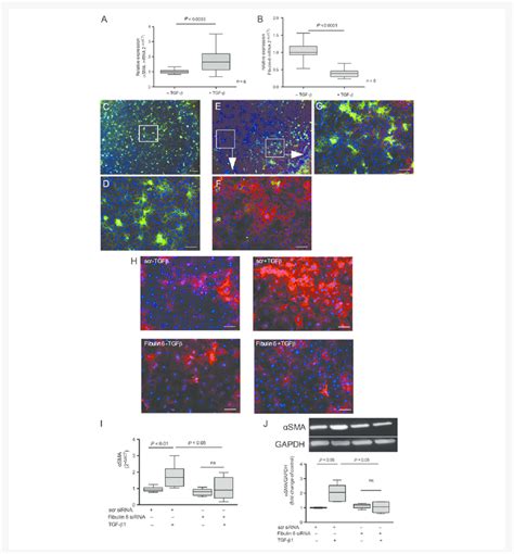 Fibulin 6 expression by fibroblasts in vitro fibulin 6 ¼ green a SMA