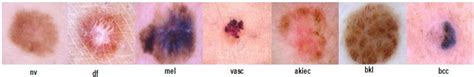 Sensors Free Full Text Multiclass Skin Lesion Classification Using