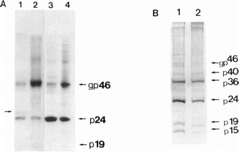 A Protein Patrern Of Viral Isolates Labelled With 35s Methionine Lane