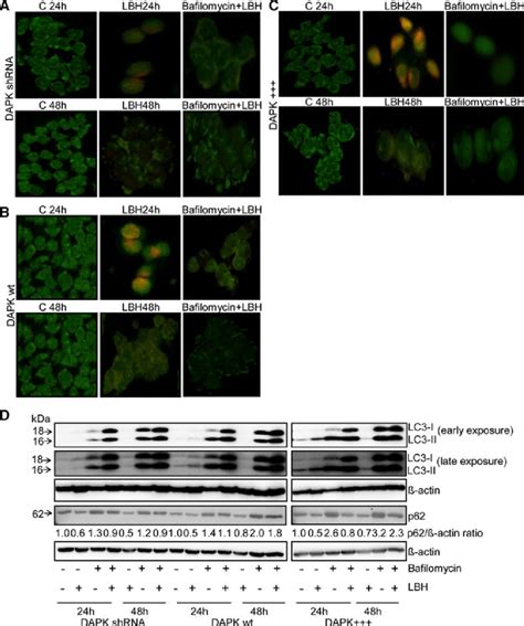 Lbh Induces Formation Of Acidic Autophagic Vacuoles And P Protein