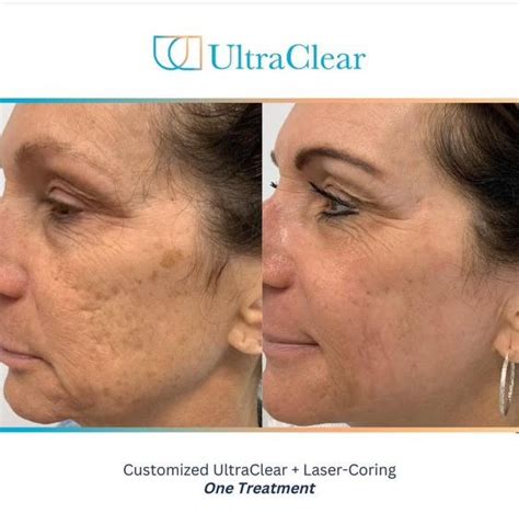 Introducing UltraClear Dermatology Arts