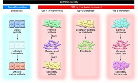 Epithelial Mesenchymal Transition Ppt