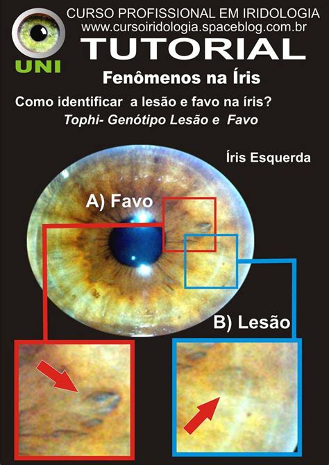 Tutoriais Do Curso De Iridologia Terapias Naturais Naturopatia