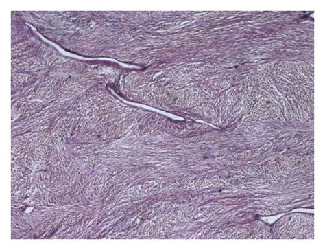 Photomicrograph Hande Stain Original Magnification ×40 Showing Oval To