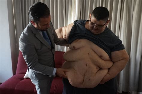 Pesaba 595 Kilos Ahora Juan Pedro Ya Camina Se Mueve Por Sí Solo Y