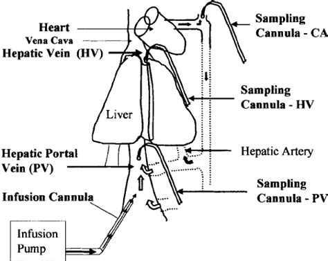 Diagram Depicting Surgical Placement Of Cannulae To Facilitate Blood