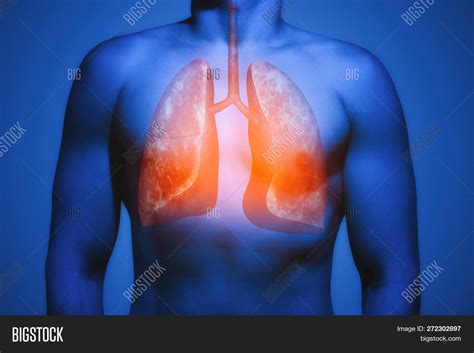 Healthy Human Lung