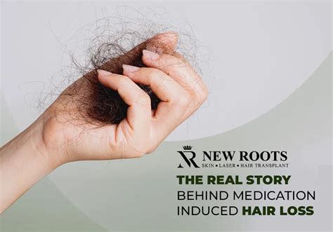 Exposing The 7 Facts Medication Induced Hair Loss Unraveled