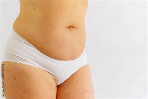 Sagging Skin With Age Spots On Fat Belly Plastic Surgery Concept Photos Adobe Stock