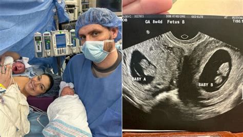 Us Woman With Double Uterus Gives Birth To Rare Twin Girls Cna