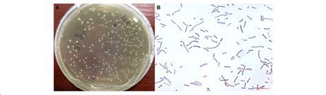 Morphological Characteristics And Observations Of Lactobacillus