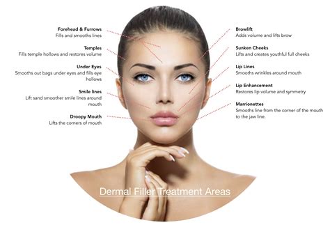 Dermal Fillers Derma Art Medspa