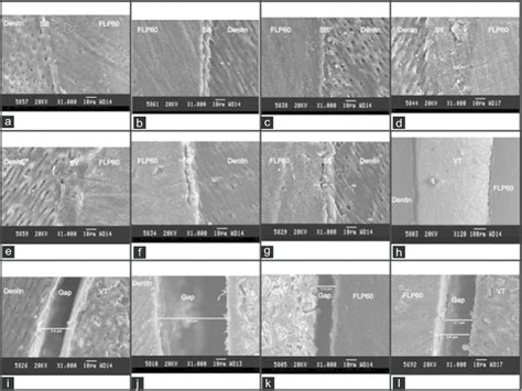 Scanning electron microscope images at 1000 magnification (a). (b and ...