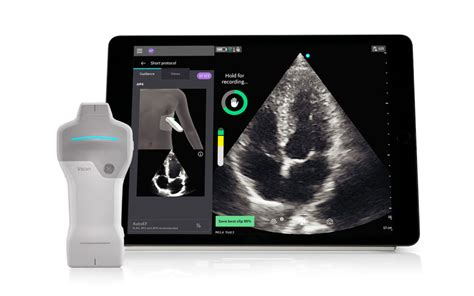 GE HealthCare Introduces Caption AI On Vscan Air SL Wireless Handheld