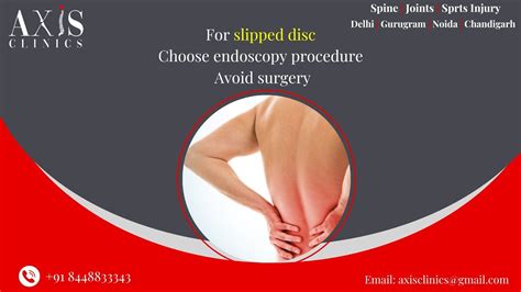 Surgery के बिना Slip Disc का इलाज Slip Disc Treatment Without Surgery Axis Clinics Youtube