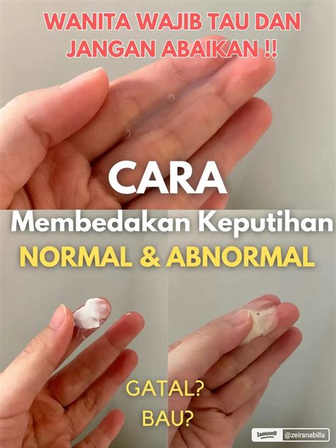 Info Kewanitaan Kenali Tekstur Keputihan Normal Dan Abnormal