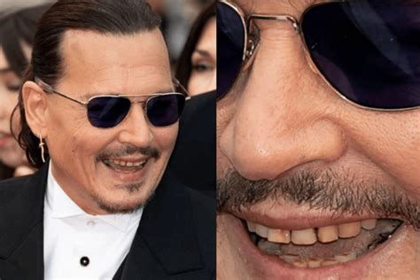 All About Johnny Depp S Teeth The Dental District