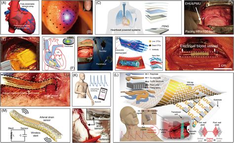 Wearable And Implantable Bioelectronics As Eco‐friendly And Patient‐friendly Integrated