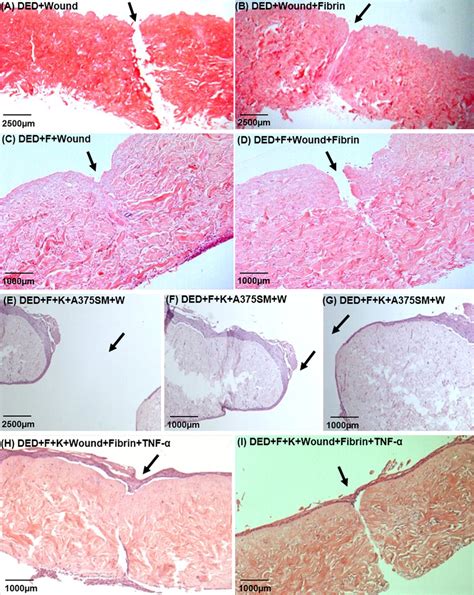 Effect of mechanical wounding and addition of fibrin and TNF-α on wound...