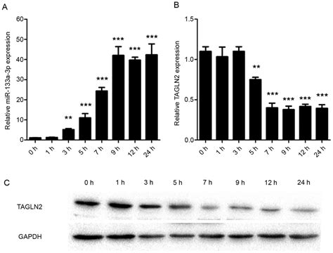 MiR 133a 3p Is Upregulated And TAGLN2 Is Downregulated In LPS Treated