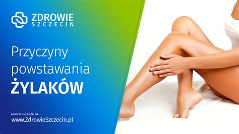 Jakie są przyczyny powstawania żylaków Zdrowie Szczecin