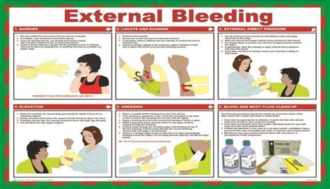 First Aid Poster External Bleeding First Aid Poster First Aid