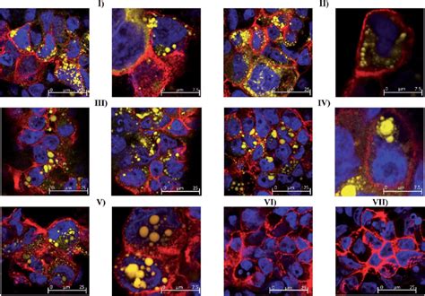 Confocal Microscope Images Of Fixed And Stained Caco Cell Monolayers