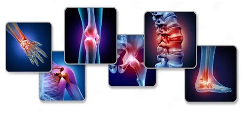 Tips For Healthy Bones And Joints To Prevent Osteoporosis
