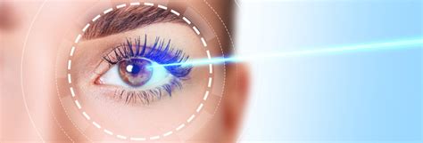 Comment La Chirurgie Oculaire Au Laser Corrige La Vision