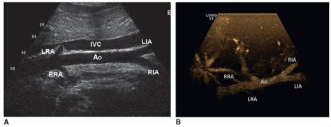 The Pediatric Abdomen Radiology Key