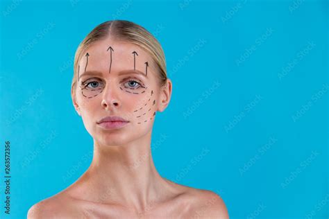 Beautician Draw Correction Lines On Woman Face Before Plastic Surgery