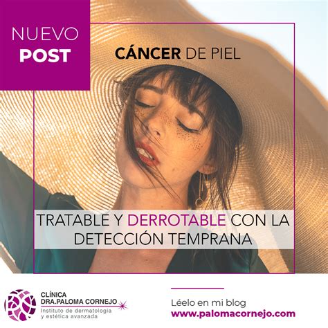 Cáncer de Piel Tratable y Derrotable con la Detección Temprana