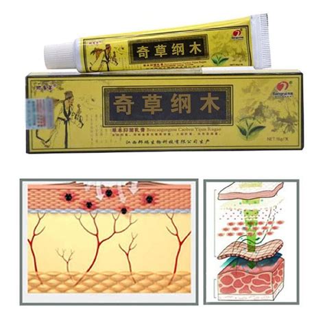 5pcs Lot Chinese Herbal Eczema Psoriasis Creams Dermatitis And Eczema