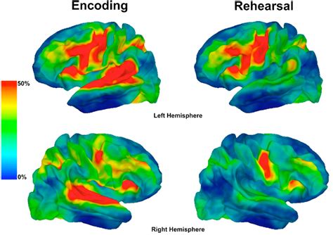 Figure 2 From Conduction Aphasia Sensory Motor Integration And