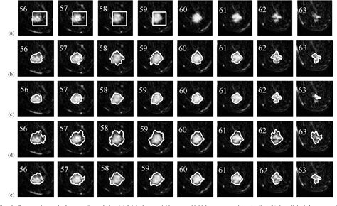 Figure From A New Background Distribution Based Active Contour Model