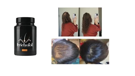 Trichofol Reviews Do This Formula Help Rejuvenate Your Hair Follicles